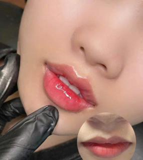Filler Hàn Vip 