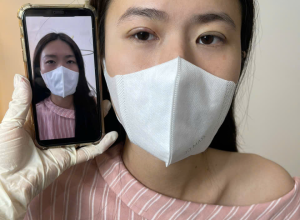 Nhấn Mí Uy Tín Tại Yến Beauty Clinic Ở Quận Tân Phú
