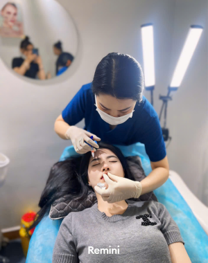 fILLER môi đẹp tại Yến Beauty 